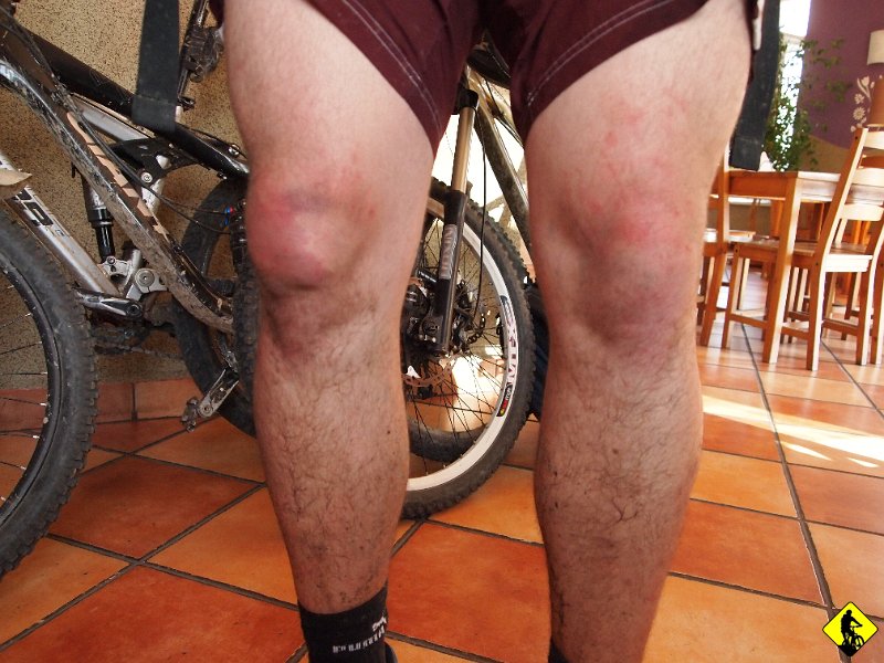 16.JPG - O! Tylko dla tych co mają problem w rozpoznaniu spuchniętego kolana --> na zdjęciu to lewe, a u niego prawe :) Bielsko witamy asfaltem. To był nasz ostatni wyjazd w tym roku :(